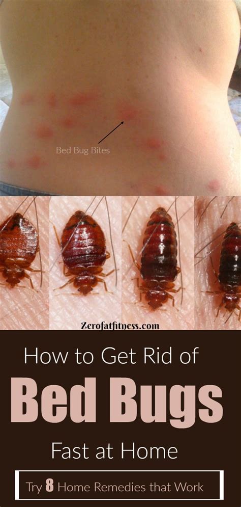How to get rid of bed bugs fast. Things To Know About How to get rid of bed bugs fast. 